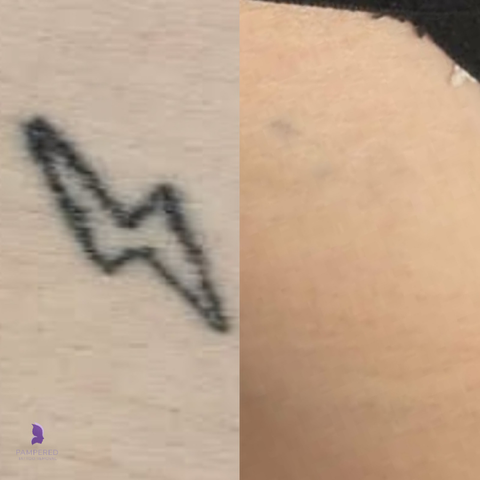 1000069428